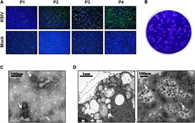 Discovery of Tick-Borne Karshi Virus Implies Misinterpretation of the Tick-Borne Encephalitis Virus Seroprevalence in Northwest China